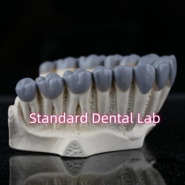 Quality SDL Dental Lab Digital Diagnostic Wax Ups Crown Bridge for sale