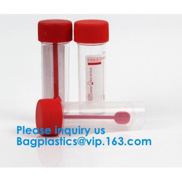 Disposable Urine Specimen Cup/Urine Sample Containers/Urine Collection Cup,Sterile Disposable Hospital Sample 60ml 100