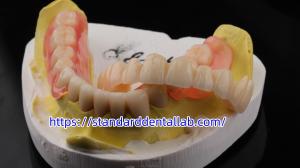 China High Esthetics Dental TCS Valplast Flexible Partial Dentures Dental Lab Valplast Clasp Pink Shade wholesale