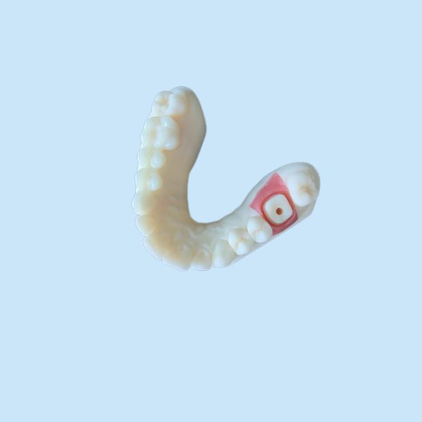 High Stability PFM Zirconia Crown Tooth Stain Resistant For Research