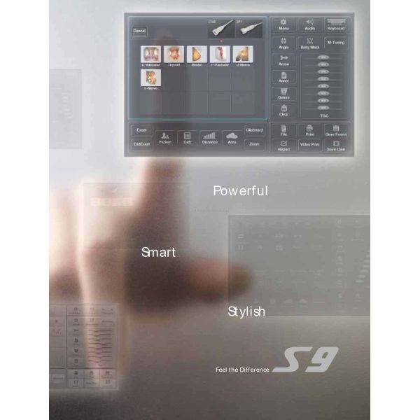 Portable 3D 4D Color Doppler USG&Sonoscape S9
