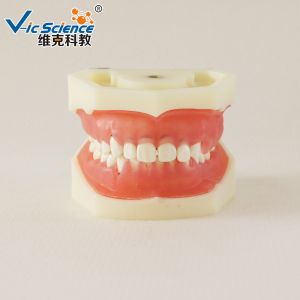 China Professional Medical Dental Study Models VIC-L5 Peridontal Disease Model wholesale