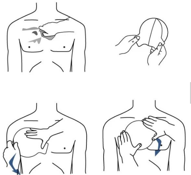 Medical Chest Seal Vented Rescue Chest Dressing Bandage Occlusive Patch Occlusive Thoracic