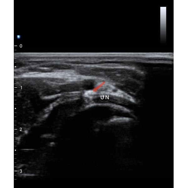 12.6cm Portable Color Doppler Ultrasound Scanner For Healthcare Professionals