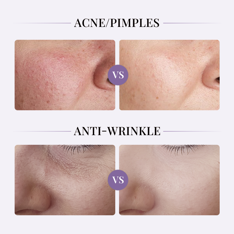 OEM ODM disposable strong hydration nourishing wrinkle removing collagen