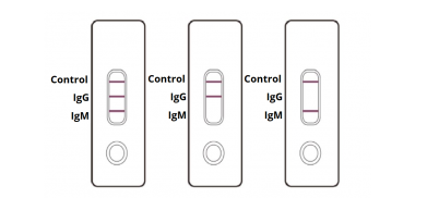 COVID-19 IgG / IgM Rapid Test Kit , COVID-19 Reagents , Rapid Test