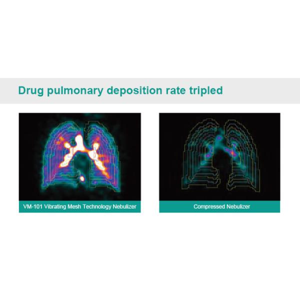 VM 101 Vibrating Mesh Technology Nebulizer For Hospital