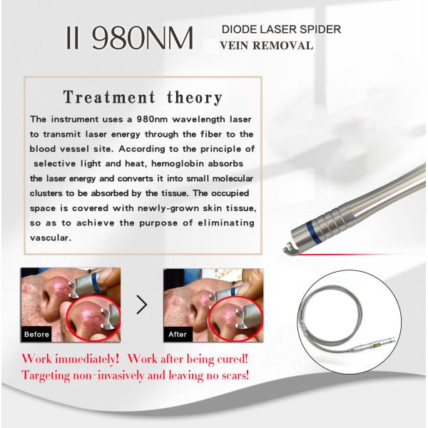 Desktop Style Hemorrhoids Treatment Portable Endolaser Evlt 980 with 1470 Endolifting Gomecy Facial Laser Diode Machine