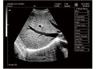 Mobile Ultrasound Machine Digital Laptop Ultrasound Scanner with 100 Frames
