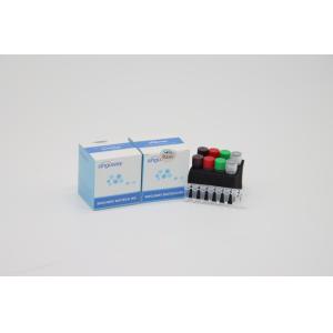 China High Precision HIV Real Time PCR Kit POCT IVD Clinical Real Time PCR Diagnostic Kits on sale