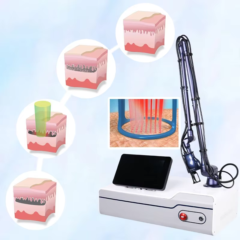 Metal RF Tube Fractional CO2 Laser For Skin Rejuvenation Vaginal Tightening