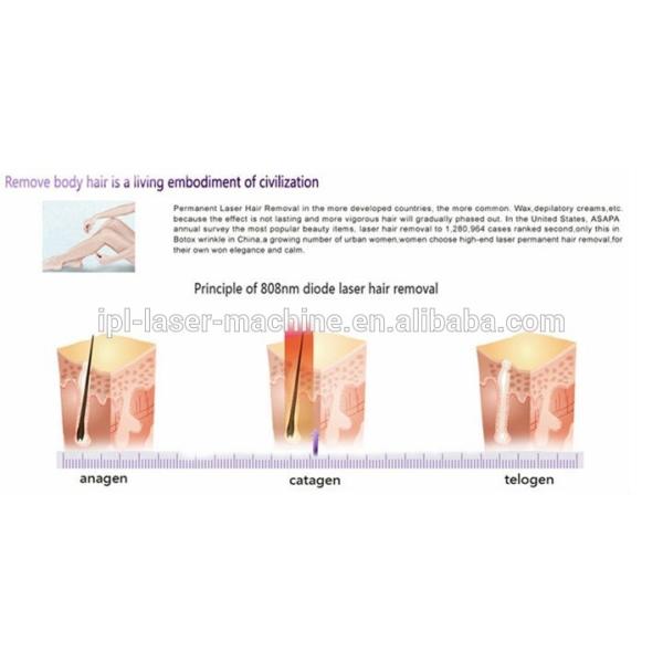 Permanent diode laser hair removal machine for Spa or Salon use