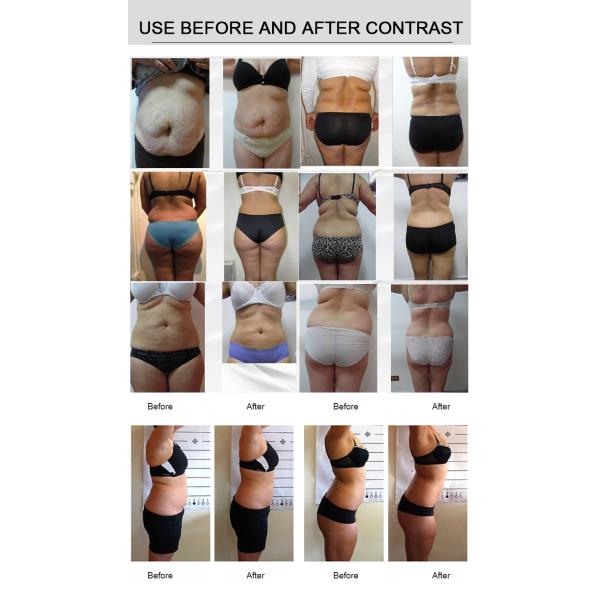 Four Wavelength Diode Zero Laser Lipo Laser Therapy Machines 12 Pads Slimming Beauty Machine