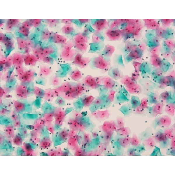 PAPANICOLAOU STAIN EA36 Baso Clear Colourful Stains for Cell Colouring