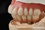 Good Elasticity Dental Acrylic Denture Finish With Tooth Arrangement Technology