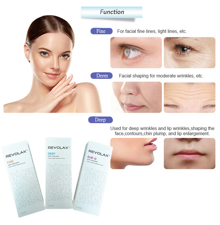Deep Fine Neck Wrinkles Revolax Hyaluronic Acid Korea Dermal Filler For Forehead Lines