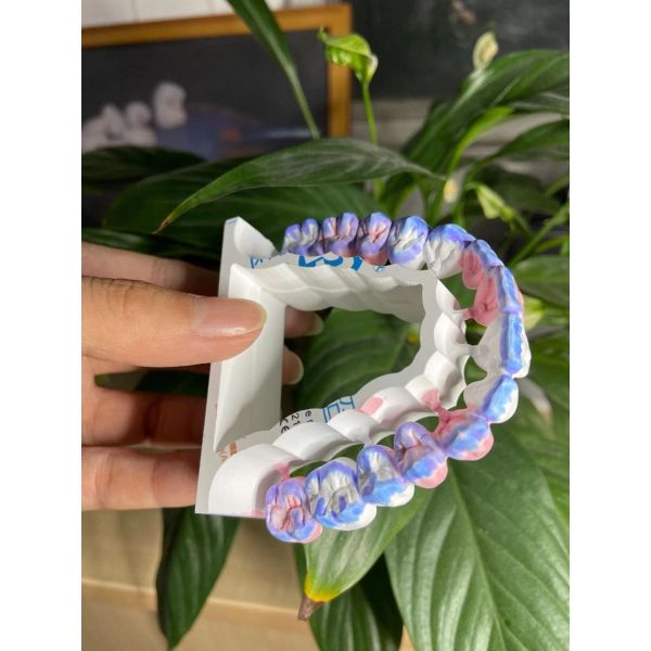 Vita 16 Color 1200Mpa Dental Zirconia Block High MPA For Bridge