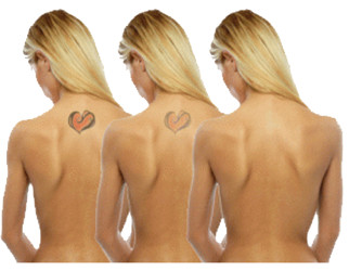 Small 808nm Center Wavelength Laser Stack Ice Laser Press The Button Constant Spectral Output