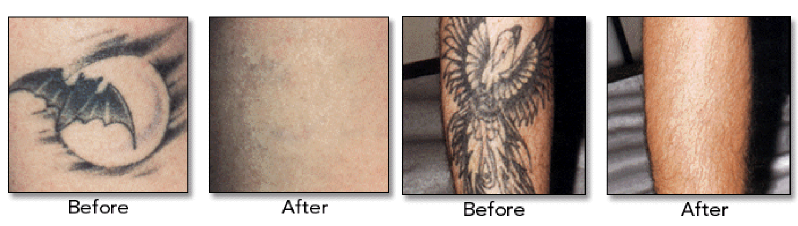 White Professional Laser Tattoo Removal Machine , Salon Beauty Machine With Cooling System