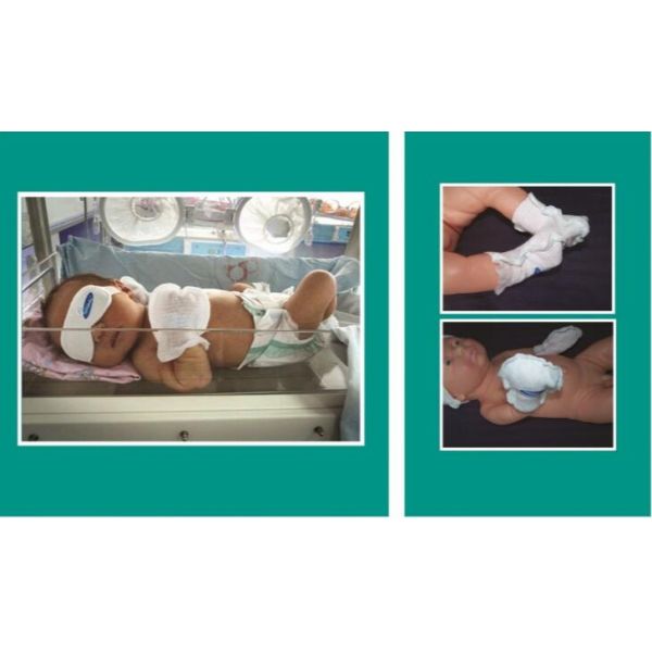 Gloves / Foot Straps Disposable Baby Products Medical For Newborn