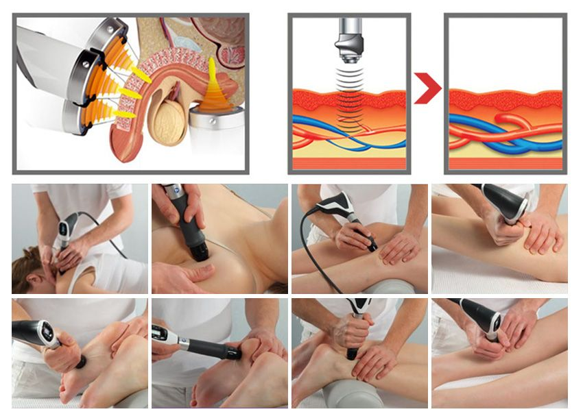 21hz Shock wave Device Intensity Extracorporeal Shockwave Therapy For Plantar Fasciitis Pain Healing