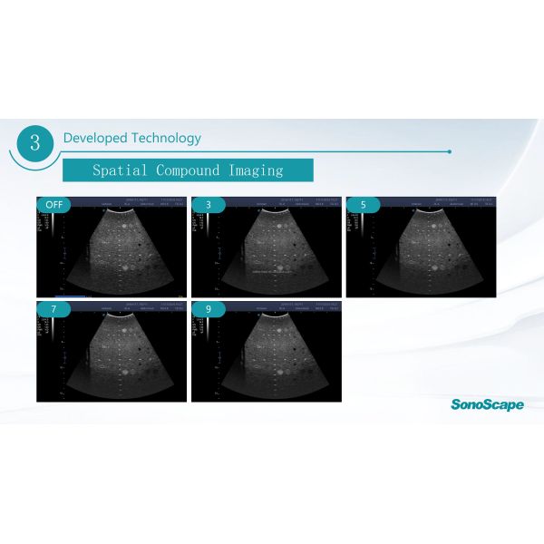 MSK Ultrasound TDI CW Color Sonoscape E2 E3 & Sonoscape E1 Usg