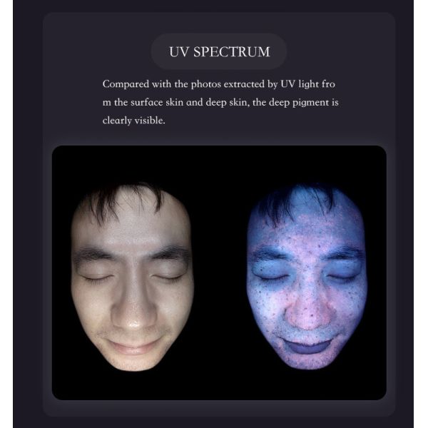 AI Facial Skin Scanner Analyzer 50Hz-60Hz Skin Analysis Equipment For Home / Spa