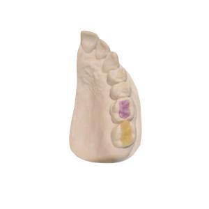China Custom High-Density Custom Dental Ceramics FDA All-Ceramic Crown on sale