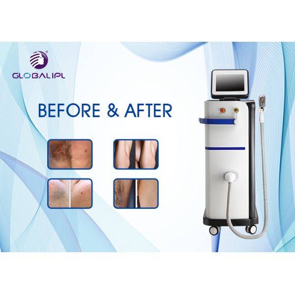 Multifunctional Diode Laser Beauty Machine For Hair Removal / Skin Rejuvenation