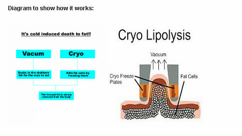 MSNLite catchScreen 2013-09-12 15_13_47.jpg