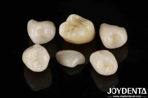China Easy Cementation Emax Inlay Onlay Medium Strength Natural-looking Esthetics wholesale