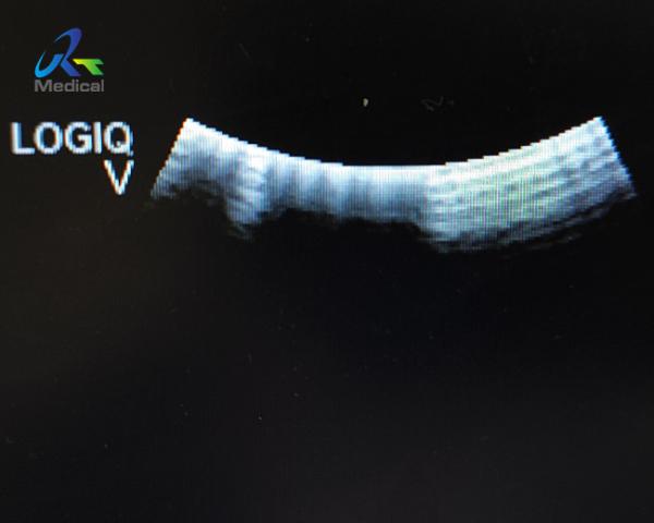 Quality Efficient Ultrasound Probe Overhaul Maintenance And Repair Service for sale